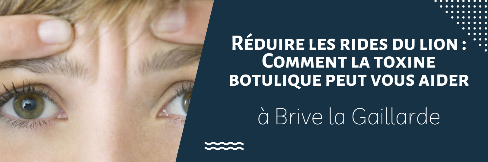 Réduire les rides du lion : Comment la toxine botulique peut vous aider