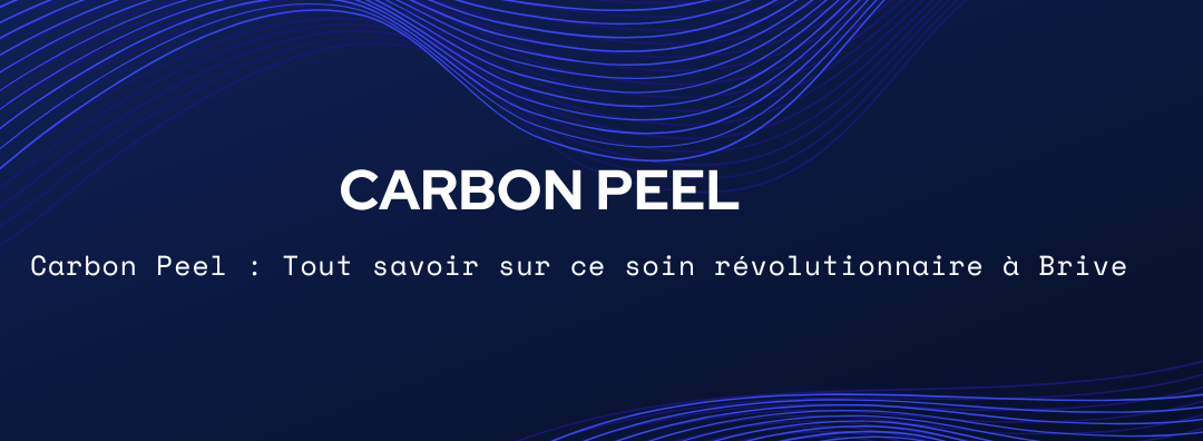 Carbon Peel : Comment ça fonctionne et quels résultats attendre ?