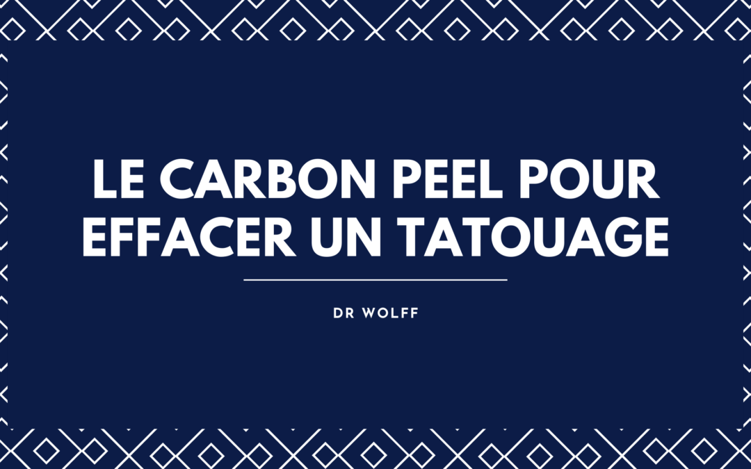 Détatouage au Laser à Brive : Le Carbon Peel pour Effacer un Tatouage