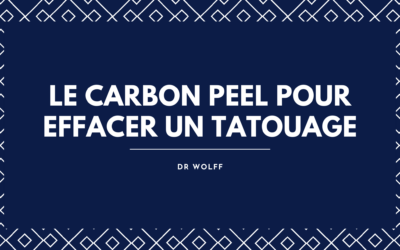 Détatouage au Laser à Brive : Le Carbon Peel pour Effacer un Tatouage