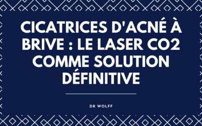 Cicatrices d&rsquo;Acné à Brive : Le Laser CO2 Comme Solution Définitive